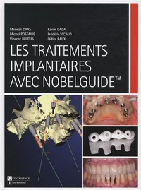 Les traitements implantaires avec Nobelguide