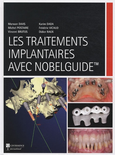 Marwan Daas - Les traitements implantaires avec Nobelguide.