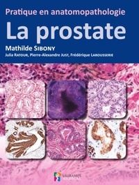 Mathilde Sibony et Julia Ratour - La prostate.
