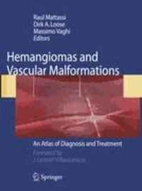 Hemangiomas and Vascular Malformations