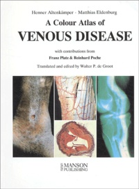 Matthias Eldenburg et Henner Altenkämper - A Colour Atlas of Venous Disease.