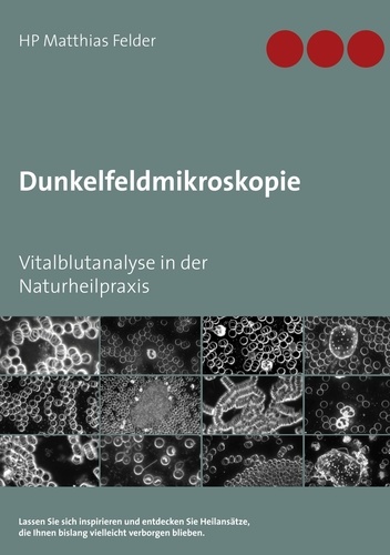 Dunkelfeldmikroskopie. Vitalblutanalyse in der Naturheilpraxis