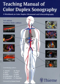 Teaching Manual of Color Duplex Sonography
