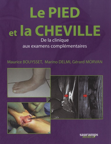 Maurice Bouysset et Marino Delmi - Le pied et la cheville - De la clinique aux examens complémentaires.