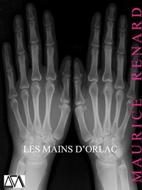 Les Mains d'Orlac