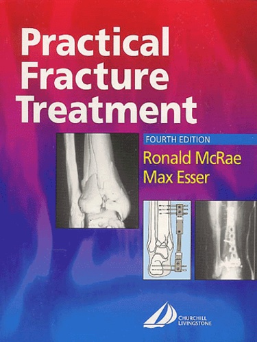 Max Esser et Ronald McRae - Practical Fracture Treatment. 4th Edition.