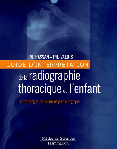 Max Hassan et Philippe Valois - Guide d'interprétation de la radiographie thoracique de l'enfant - Sémiologie normale et pathologique.