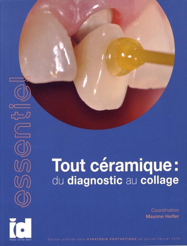 Tout céramique : du diagnostic au collage