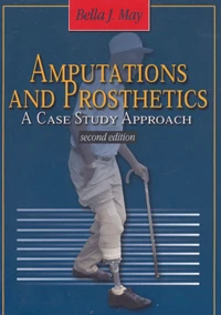 Amputations and Prosthetics