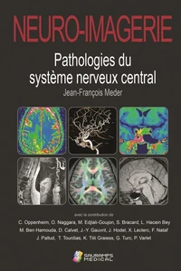 Neuro-imagerie
