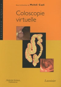 Coloscopie virtuelle