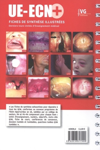 ORL - Stomatologie - Chirurgie maxillo-faciale  Edition 2021