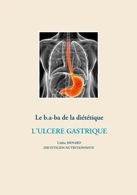 Le B.a.-ba de la diététique pour l'ulcère gastrique