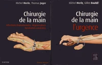 Chirurgie de la main