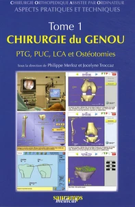 Chirurgie orthopédique assistée par ordinateur