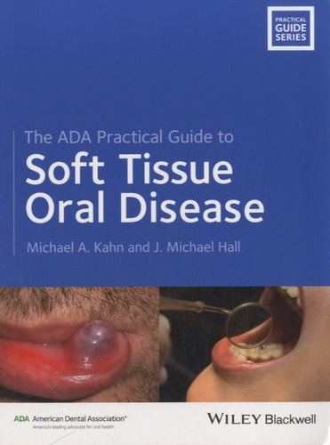 Michael-A Kahn et Michael Hall - The ADA Practical Guide to Soft Tissue Oral Disease.