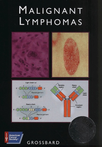 Michael-L Grossbard - Atlas Of Clinical Oncology : Malignant Lymphomas. Cd-Rom Inclued.