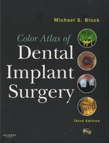 Michael S. Block - Color Atlas of Dental Implant Surgery. 1 DVD