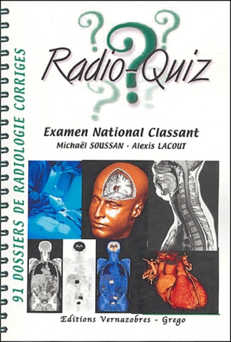 Michaël Soussan et Alexis Lacout - Radio-Quiz - 91 dossiers de radiologie corrigés Examen National Classant.