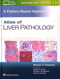 Michael Torbenson - Atlas of Liver Pathology - A Pattern-Based Approach.