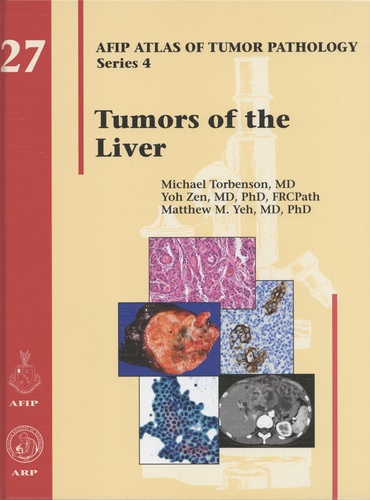 Michael Torbenson et Yoh Zen - Tumors of the Liver.