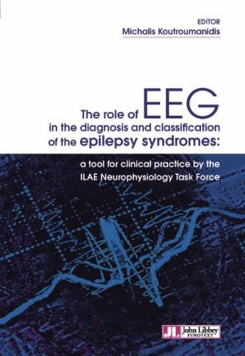 The role of EEG in the diagnosis and classification of the epilepsy syndromes