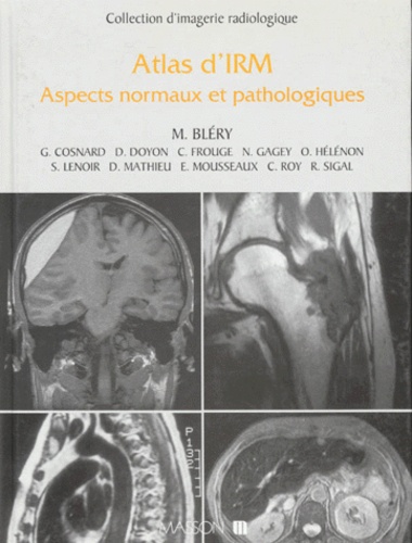 Michel Bléry et  Collectif - Atlas D'Irm. Aspects Normaux Et Pathologiques.