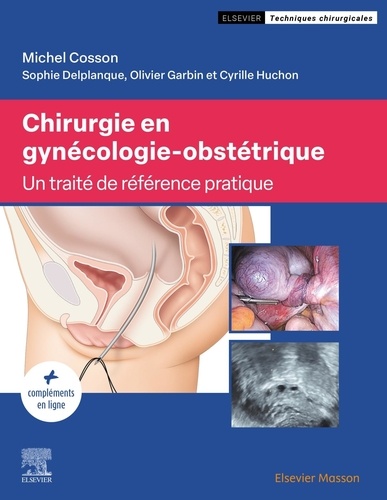 Michel Cosson et Sophie Delplanque - Chirurgie en gynécologie-obstétrique.