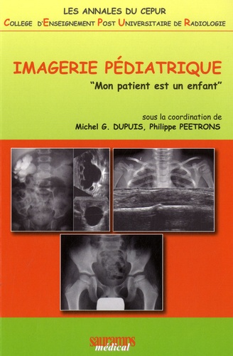 Michel Dupuis et Philippe Peetrons - Imagerie pédiatrique - "Mon patient est un enfant".