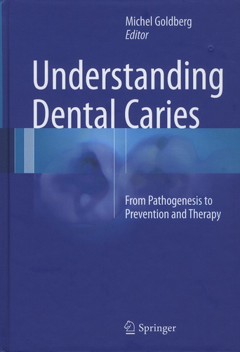 Michel Goldberg - Understanding Dental Caries - From Pathogenesis to Prevention and Therapy.