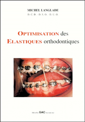 Optimisation des élastiques orthodontiques - Michel Langlade