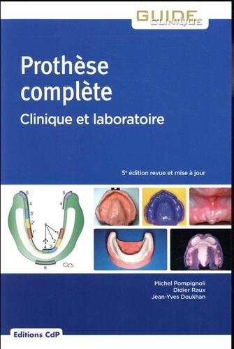 Michel Pompignoli et Didier Raux - Prothèse complète - Clinique et laboratoire.