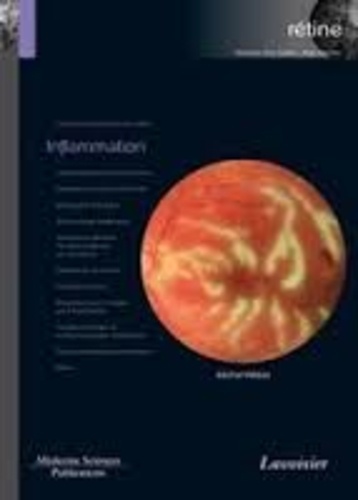 Rétine. Tome 4, Inflammation