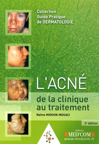 L'acné de la clinique au traitement