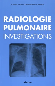 Radiologie pulmonaire : investigations