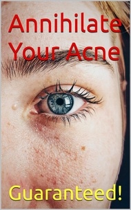  Mike Mains - Annihilate Your Acne: How to Get Rid of Acne and Create Beautiful, Clear Skin; Your Easy, Proven Plan to Get Rid of Acne Fast.