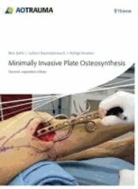 Minimally Invasive Plate Ostheosynthesis (MIPO).
