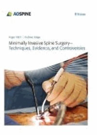 Minimally Invasive Spine Surgery - Techniques, Evidence, and Controversies.