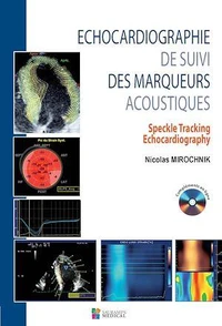 Echocardiographie de suivi des marqueurs acoustiques