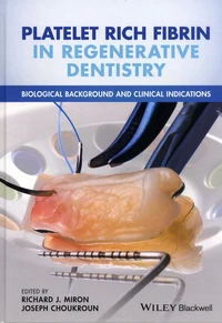 Platelet Rich Fibrin in Regenerative Dentistry