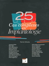 25 cas complexes en implantologie