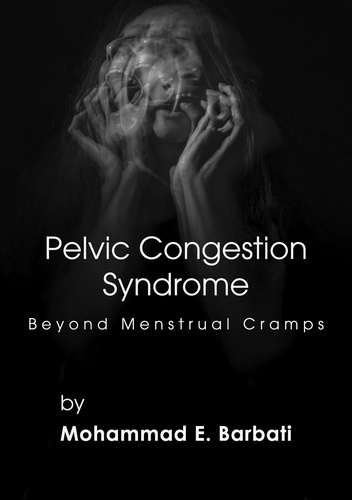  Mohammad E. Barbati - Pelvic Congestion Syndrome - Beyond Menstrual Cramps.