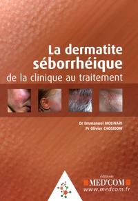 La dermatie séborrhéique