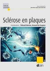 Sclérose en plaques
