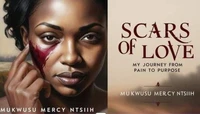 SCARS OF LOVE: My Journey from Pain to Purpose