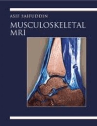 Musculoskeletal MRI.