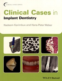 Nadeem Karimbux et Hans-Peter Weber - Clinical Cases in Implant Dentistry.
