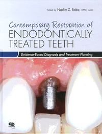 Nadim Baba - Contemporary restoration of endodontically treated teeth - Evidence-based diagnosis and treatment planning.