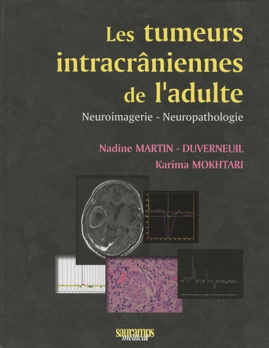 Nadine Martin-Duverneuil et Karima Mokhtari - Les tumeurs intracrâniennes de l'adulte à l'exclusion de la base du crâne et de la région hypophysaire - Neuroimagerie- Neuropathologie.