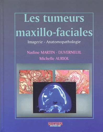 Nadine Martin-Duverneuil et Michelle Auriol - Les tumeurs maxillo-faciales - Imagerie - Anatomopathologie.